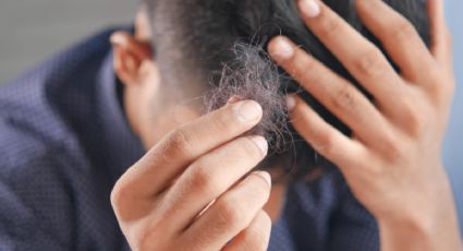 Alopecia: La mascarilla definitiva para que el cabello crezca para siempre