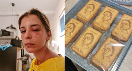 Tenía un ojo dañado con una perrilla, su novio le tomó una fotografía y le regaló galletas personalizadas