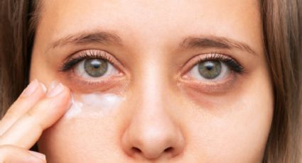 Solo con cúrcuma y aloe vera: aprende a quitar las ojeras