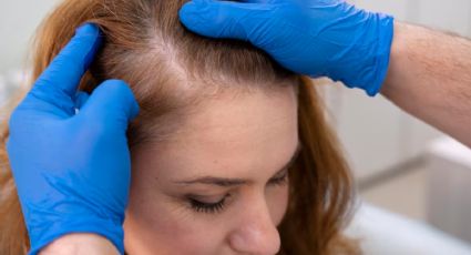 Prepara este tinte natural con jengibre para decirle adiós a las canas al instante