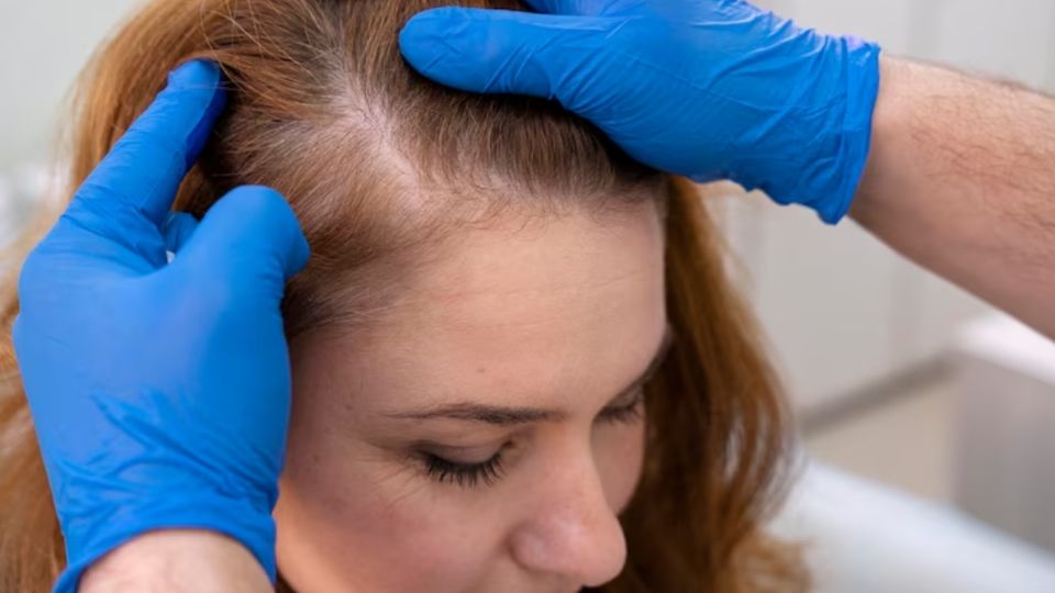 Al usar tintes que eliminen las canas, el cabello sufre resequedad.