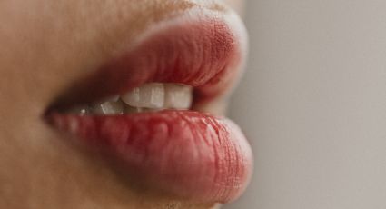 ¿Labios partidos? El tratamiento casero definitivo para curarlos