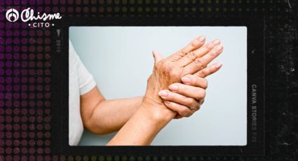 Solo con miel y clavo de olor, preparara una crema casera para revitalizar tus manos viejas y arrugadas