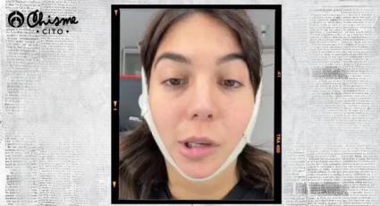 Influencer quiso quitarse un poco de papada y terminó sufriendo una parálisis facial