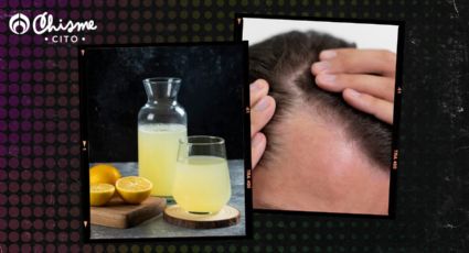 Alopecia: elimínala para siempre y recupera el cabello, solo con jugo de limón