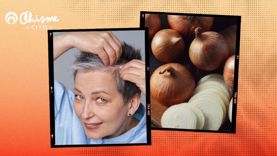 La cebolla, cuando se mezcla con ajo y limón, es muy útil para enfrentar la alopecia.