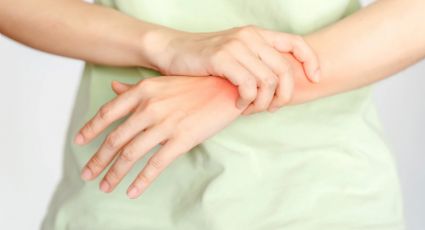 ¿Cuáles son los tipos de artritis y cuáles son sus síntomas?