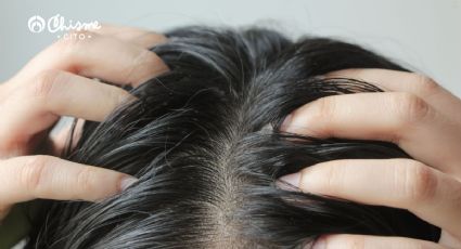 Revierte el cabello graso con el extracto de esta planta de tu jardín