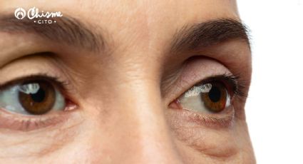 6 malos hábitos que causan bolsas debajo de los ojos