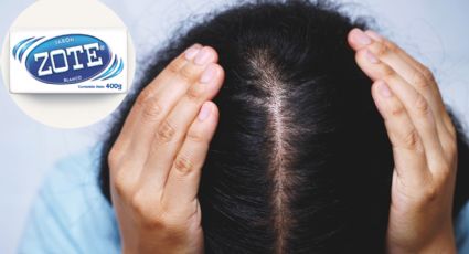 ¿Qué pasa si usas jabón Zote para luchar contra la alopecia? Esto señalan los expertos