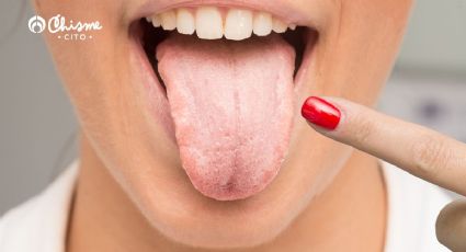 ¿Boca seca? 3 señales que indican que tu saliva no está saludable