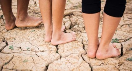 ¿Tienes los talones resecos y agrietados? Puede ser síntoma de esta grave enfermedad