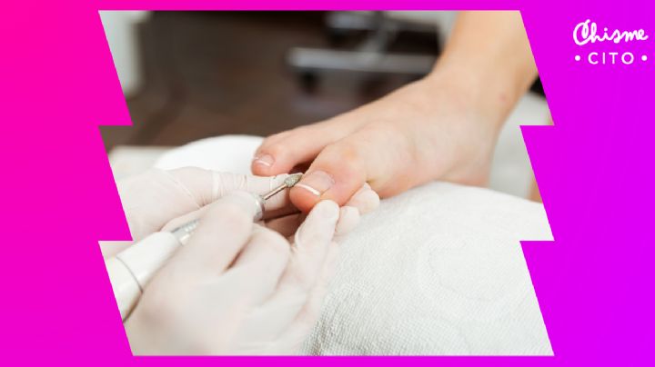 ¿Uñas enterradas? Así de fácil puedes tratarlas en casa con unos simples pasos
