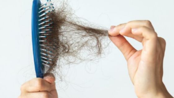 Estos son los 5 mejores consejos para evitar la caída del cabello y mantenerlo fuerte y sano