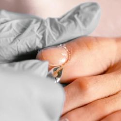 Uñas enterradas: estos son los mejores consejos para tratarlas y prevenirlas