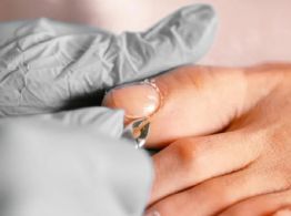 Uñas enterradas: estos son los mejores consejos para tratarlas y prevenirlas
