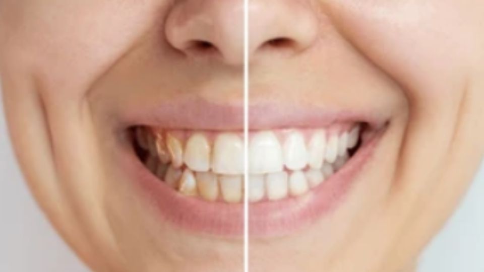 Así podrás conseguir unos dientes relucientes con pocos ingredientes.
