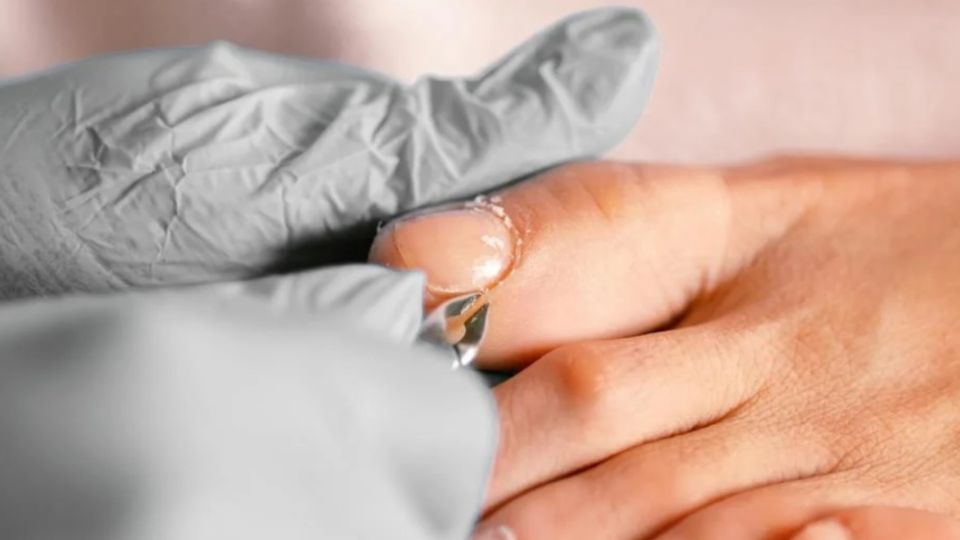 Conoce por qué se te entierran las uñas de los pies.