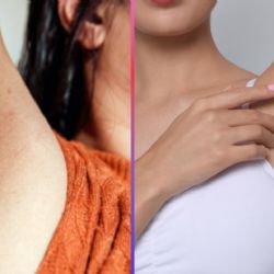 ¿Axilas oscuras? El remedio casero con dos ingredientes para aclararlas de forma natural