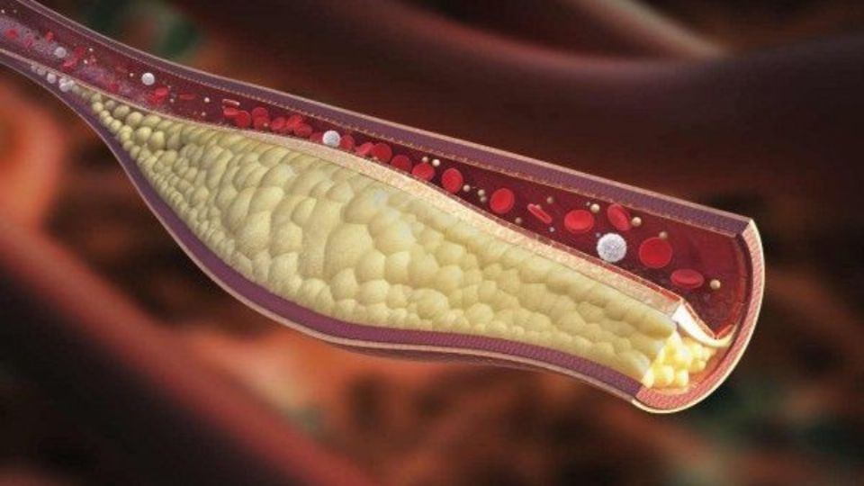 Así podrás reducir el colesterol en sangre