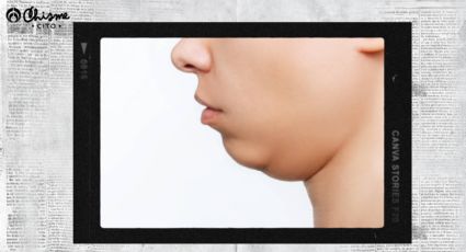 Sin cirugías, aprende a eliminar la papada con solo dos movimientos