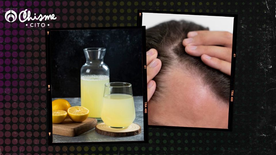El jugo de limón puede ayudarnos a superar la alopecia del cabello.