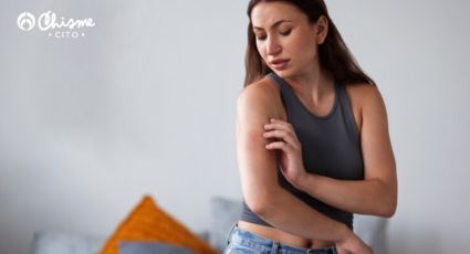 ¿Las picaduras te irritan la piel? Calma la picazón, sólo miel o aloe vera