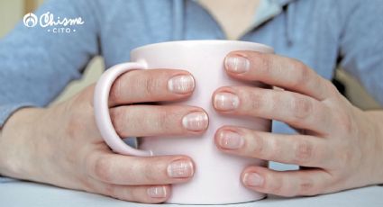 ¿Qué le ocurre a tu cuerpo cuando tienes rayas en tus uñas?