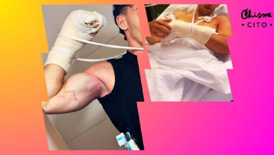 Joven influencer cae desde un acantilado y pierde dos dedos: este es su estado de salud (VIDEOS)