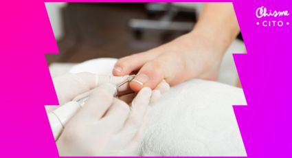 ¿Uñas enterradas? Así de fácil puedes tratarlas en casa con unos simples pasos