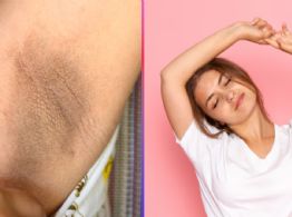 Axilas oscuras: por qué aparecen las manchas y cómo aclararlas de forma segura, según dermatólogos