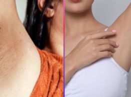 ¿Axilas oscuras? El remedio casero con dos ingredientes para aclararlas de forma natural